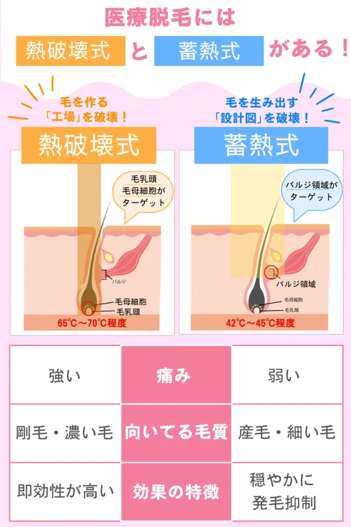医療脱毛_蓄熱式_熱破壊式
