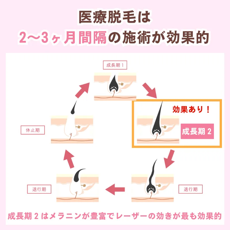 医療脱毛_おすすめ_毛周期