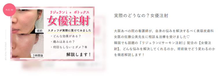 女優注射を受けたスタッフのブログ