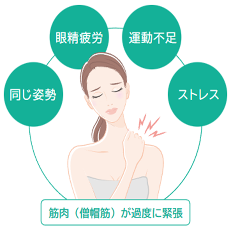 ガーデンクリニックの肩ボトックス