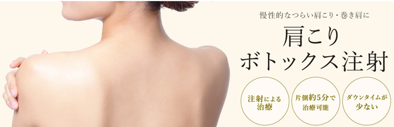 肩ボトックス注射とは