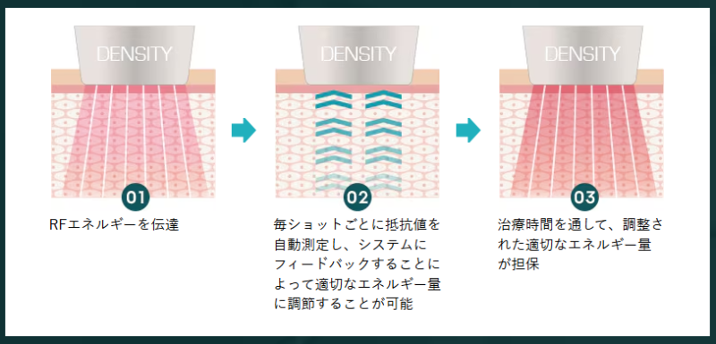 デンシティの特徴