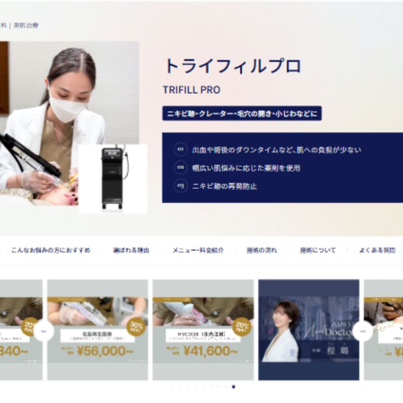 ネクサスクリニックのトライフィルプロ