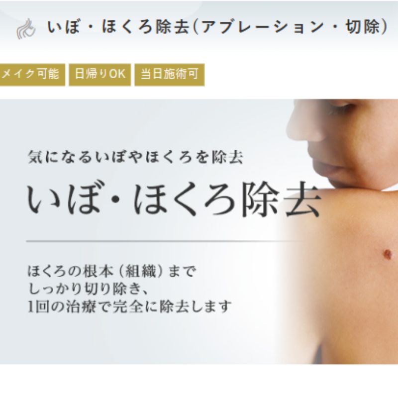 東京美容外科のホクロ除去