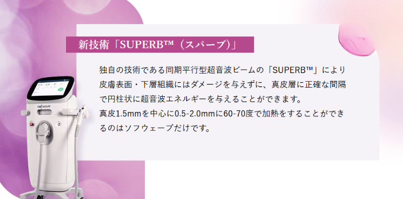 ソフウェーブの特徴