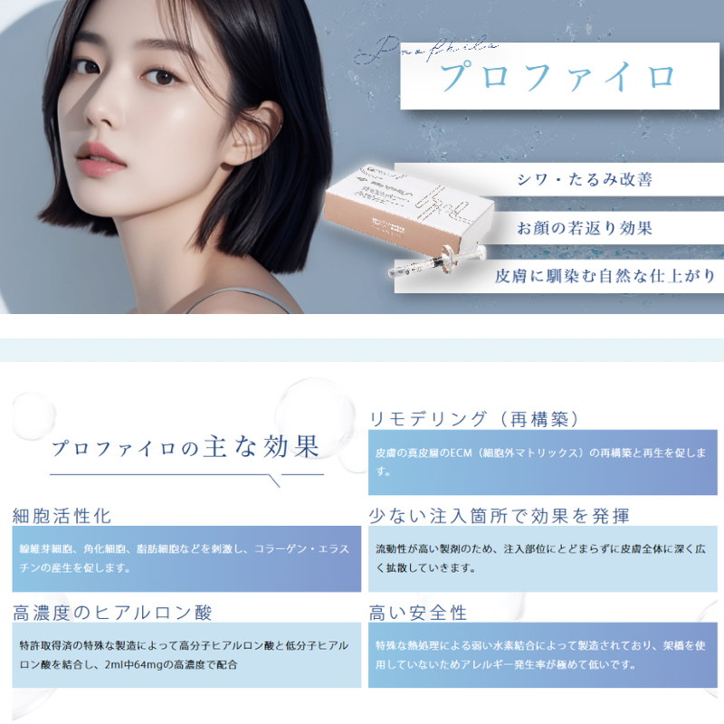 プロファイロの特徴