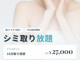 白金ビークリニックのシミ取り