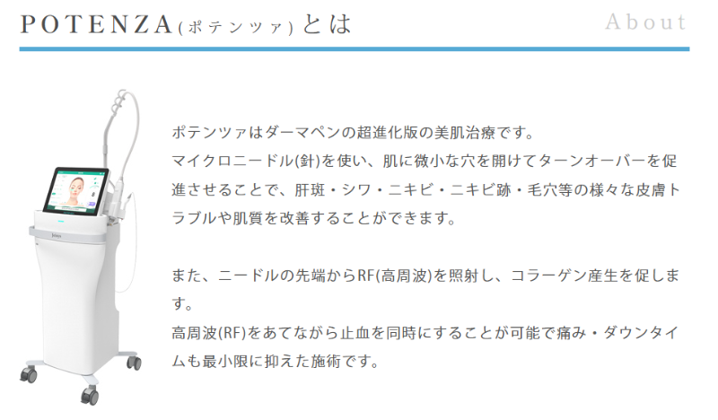 ポテンツァとは