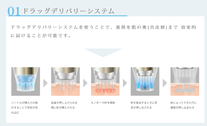 ポテンツァのドラッグデリバリーシステム
