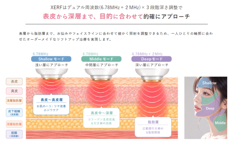 ザーフ(XERF)の効果