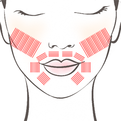 深部立体照射(筋膜層)の3Dリフトアップ・タイトニング